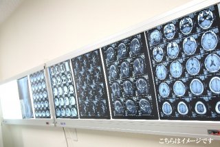 脳神経外科医師の転職案件